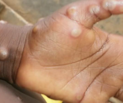 hk_c_1683076970179049348.png hk_c_image.png